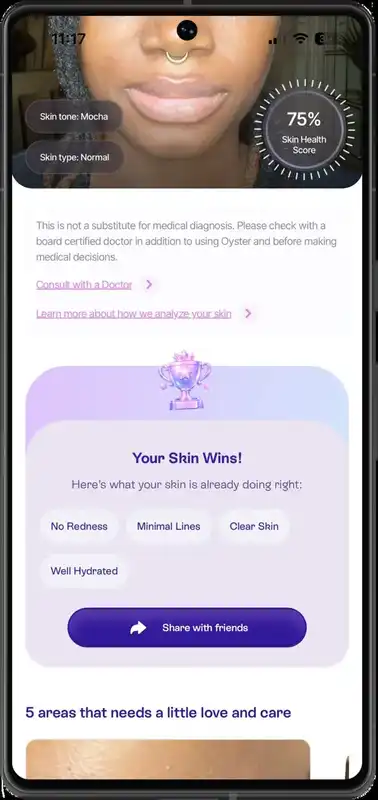 Oyster skin analysis with concerns and score